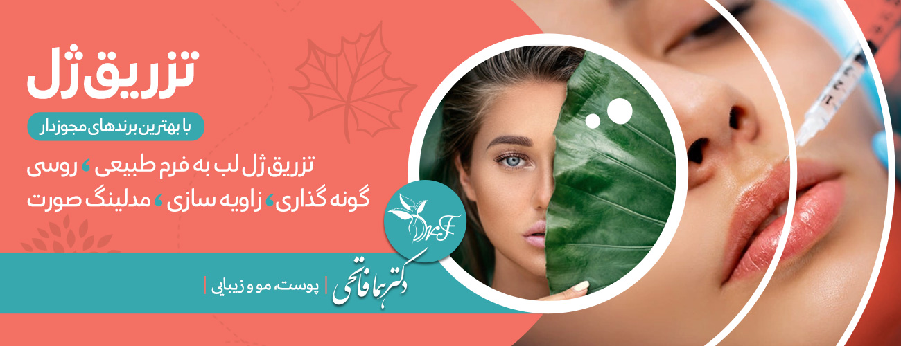 درمان ریزش موی مردانه در اصفهان | بهترین درمان ریزش مو در اصفهان